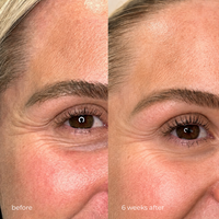 R-Q10 EYE CARE